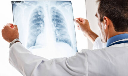 Lungenkrebs – Klinik und Forschung