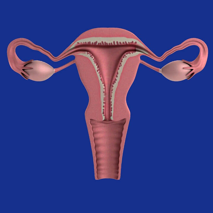 Endometriose – Verschleppte Gebärmutterschleimhautzellen