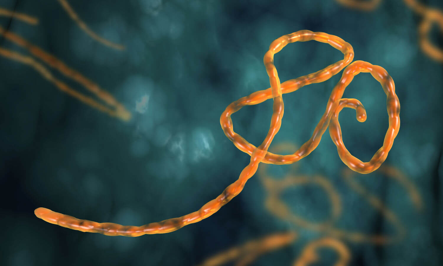 Ebola - Wo steht die Schweiz?