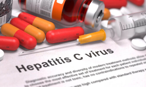 Hepatitis C – Leberentzündung durch Infektion
